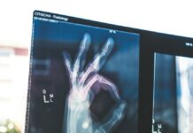 체중 감량을 위한 실용적인 운동과 식단 조합 citiscan result hand ok