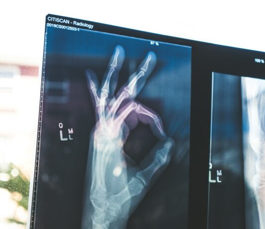 체중 감량을 위한 실용적인 운동과 식단 조합 citiscan result hand ok